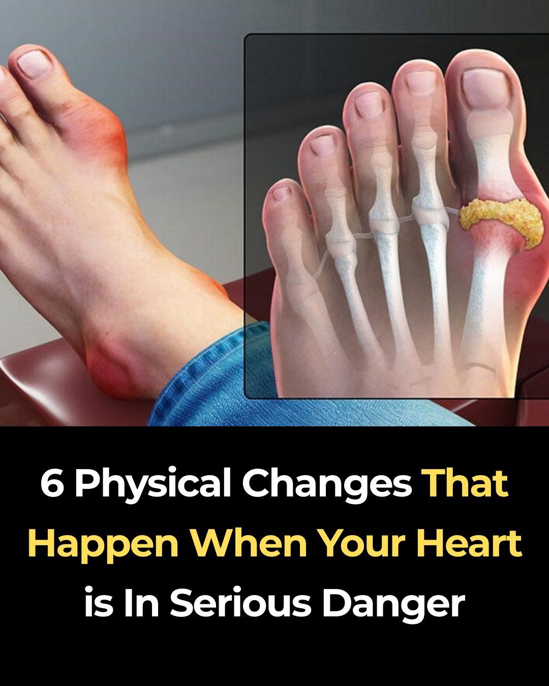 Your Body May Show These 6 Signs When Your Heart Health Is at Risk