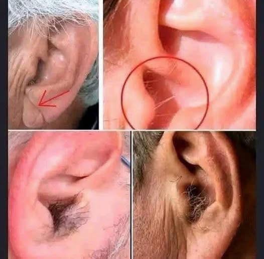 Why Hair Grows on Your Ears as You Age: The Science Behind This Common Change