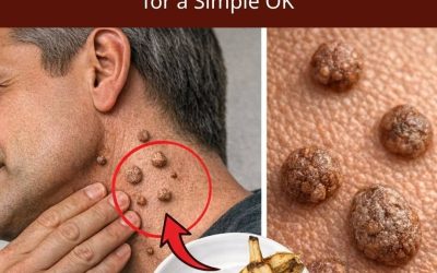 The warts will fall off like leaves simply by applying this home treatment. I’ll give you the recipe in exchange for just one word, 2