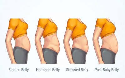 4 Types of Big Bellies That Aren’t Caused By Overweight1